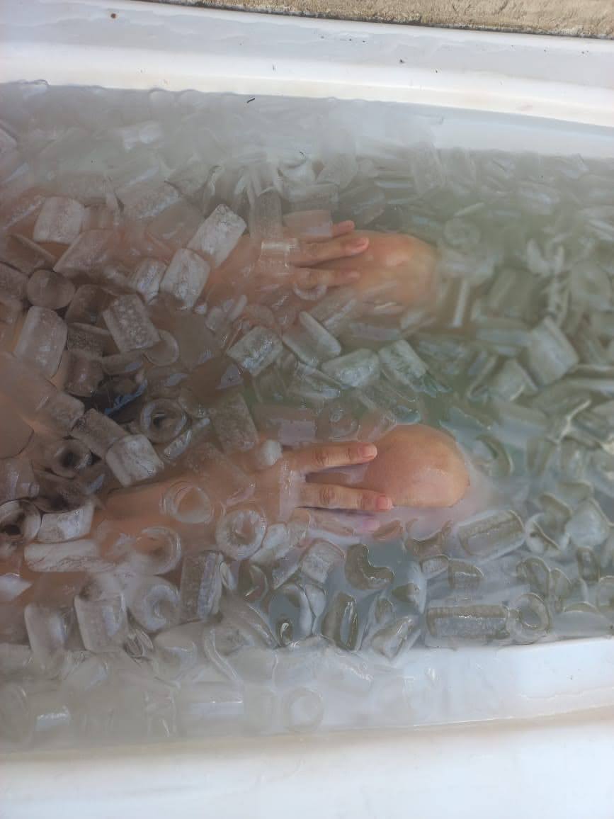 experiencia en el hielo